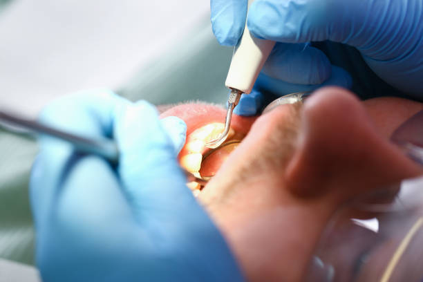 Best Chipped Tooth Repair Near Me  in Caney, KS