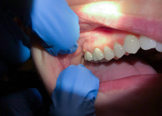 Best Teeth Whitening  in Caney, KS