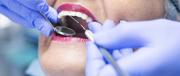 Best Teeth Whitening  in Caney, KS